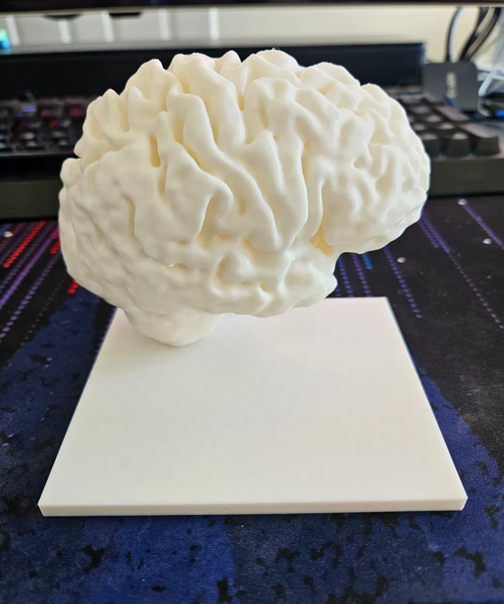 Bookends made from Human Brain MRI (papadansmaman), photo 3 of 4 - Bookends made from Human Brain MRI (papadansmaman) Desk & Office