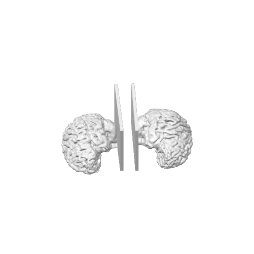 Bookends made from Human Brain MRI (papadansmaman), photo 4 of 4 - Bookends made from Human Brain MRI (papadansmaman) Desk & Office