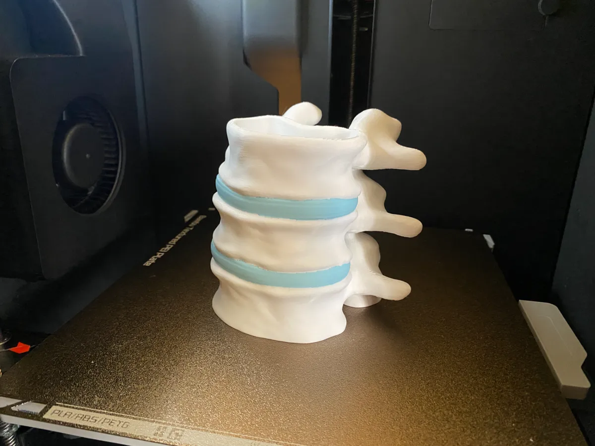 Vertebrae-Inspired Pen Holder, photo 4 of 4 - Vertebrae-Inspired Pen Holder Education