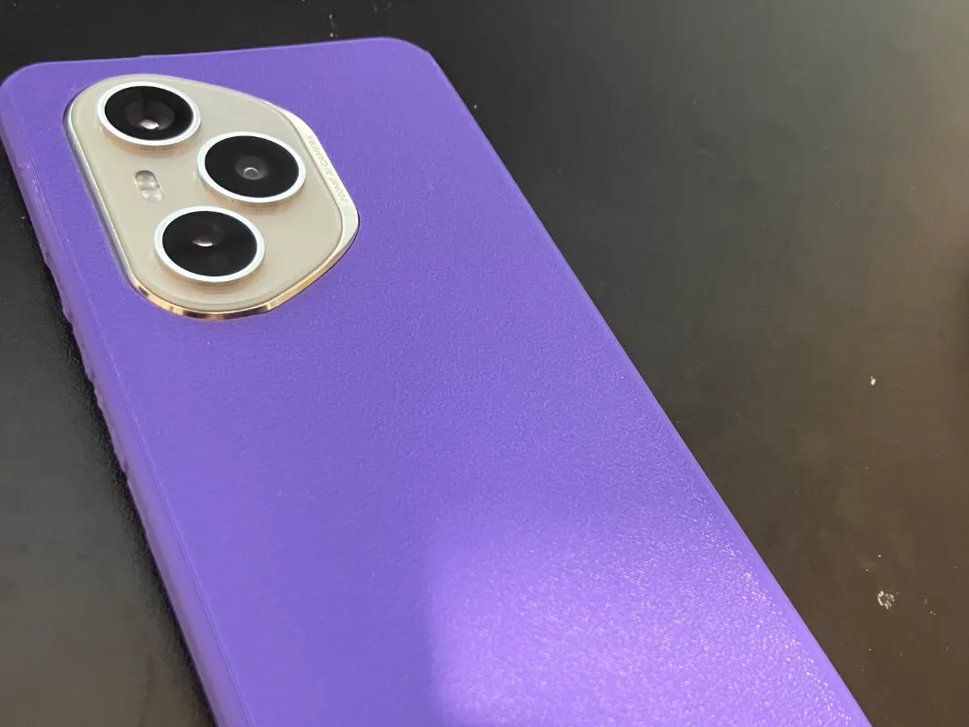 Honor 400 Pro Case