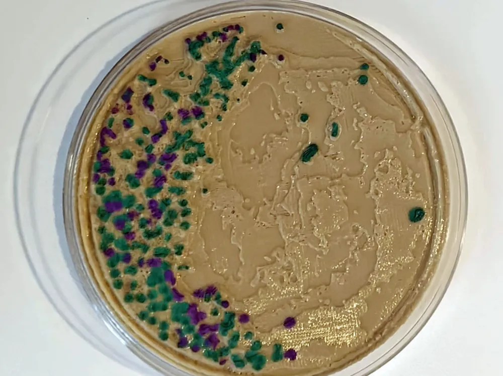 Salmonella Agar Plate - Biology, in stock in India