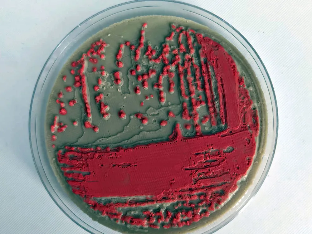 Salmonella Agar Plate, photo 2 of 3 - Salmonella Agar Plate Education